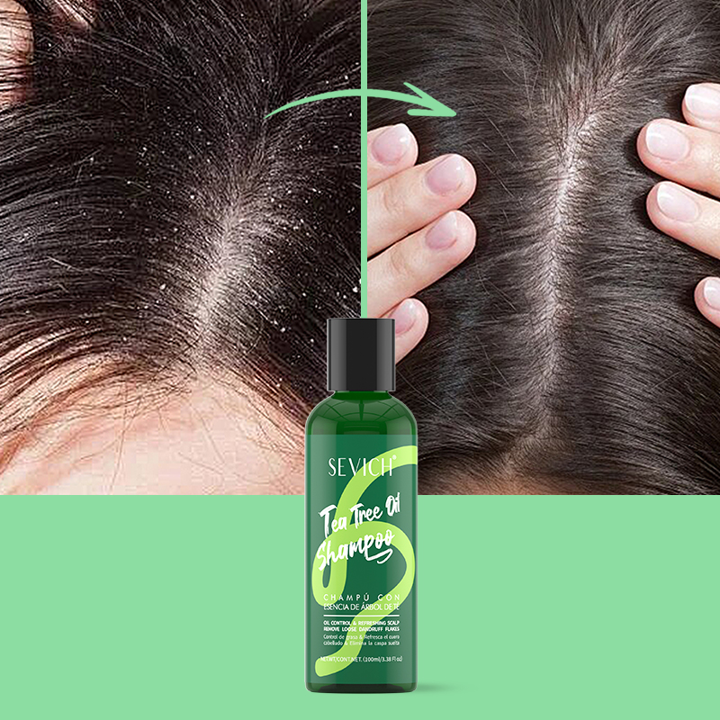 Tea Tree Essence Shampoo Balsa - Hair Care Essence recensione e prezzo