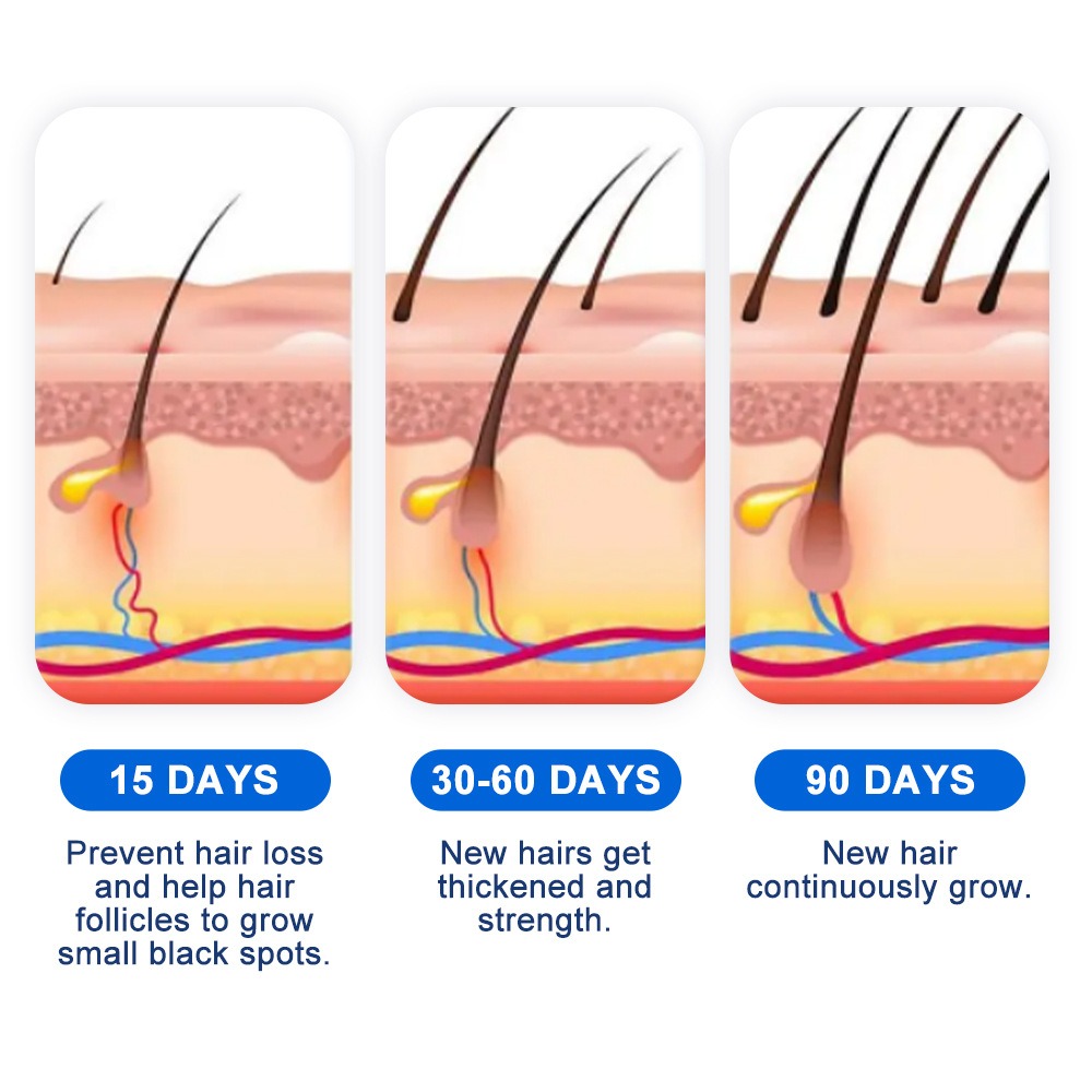 Alopecia Spray per la crescita - Hair Care Growth recensione e prezzo