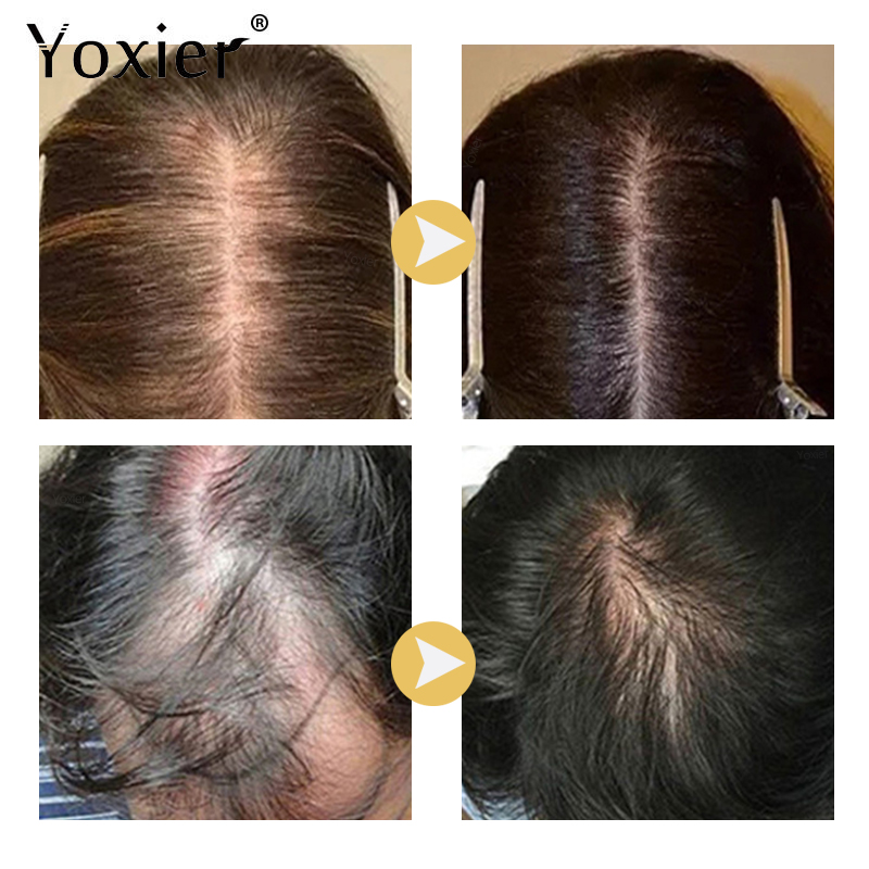 Siero per la crescita intensa  - Hair Care Growth recensione e prezzo
