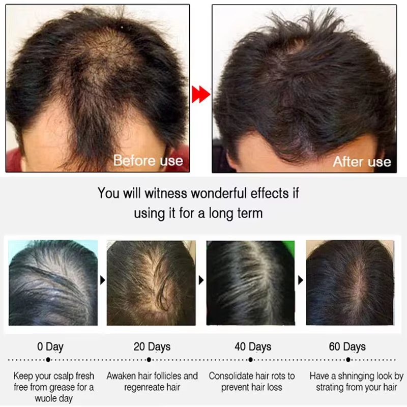Spray per Crescita Rapida dei  - Hair Care Growth recensione e prezzo